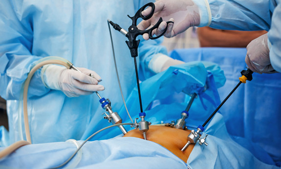 Endometriozis  tedavisi