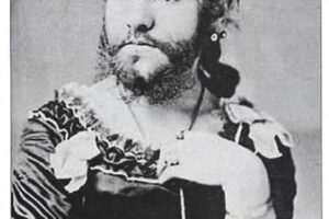 Kadınlarda Tüylenme Artışı: Nedenleri, Belirtileri ve Tedavi Yöntemleri