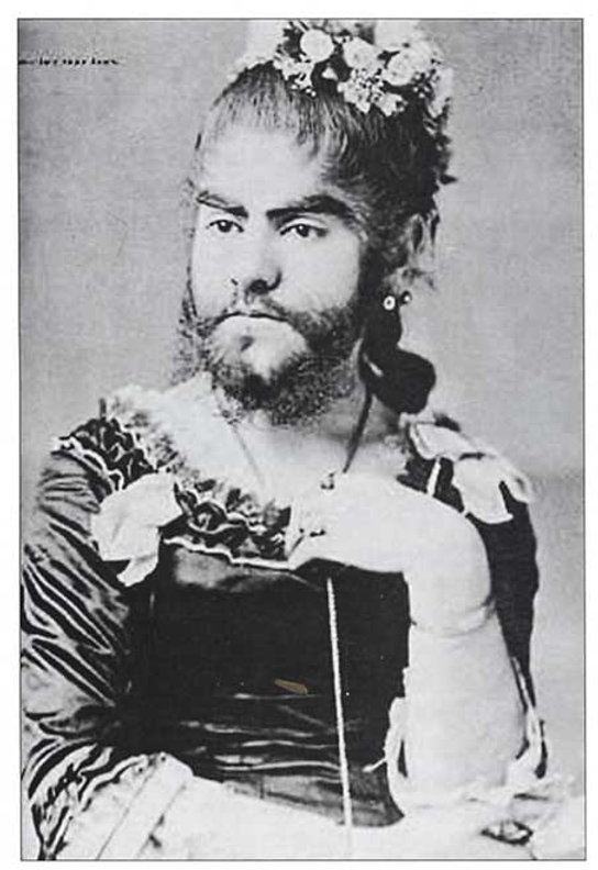 Kadınlarda Tüylenme Artışı: Nedenleri, Belirtileri ve Tedavi Yöntemleri